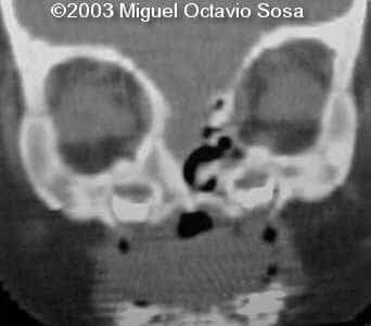 case0101-19