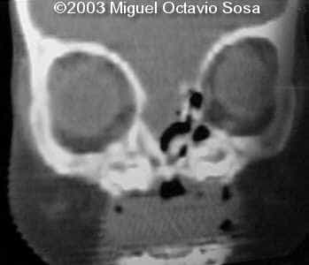case0101-20