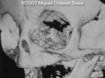 case0101-22
