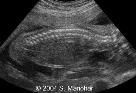 case0135_02