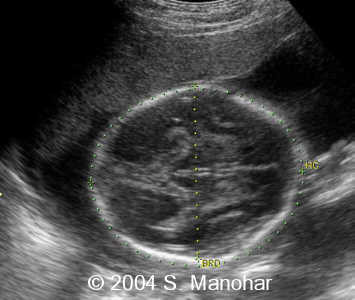 case0135_05