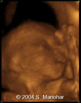 case0135_10