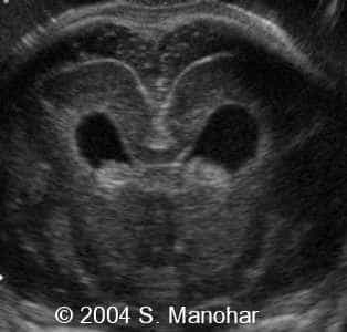 case0135_13
