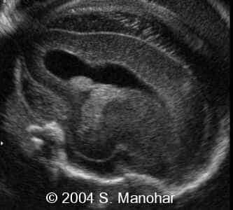 case0135_14