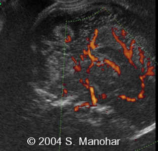case0135_15