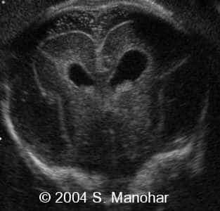 case0135_16
