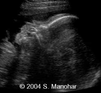 case0135_17