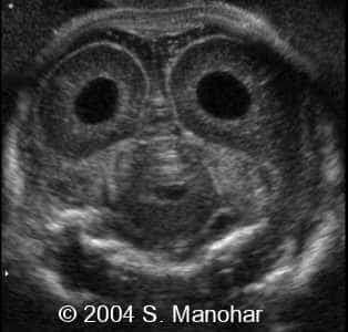 case0135_22