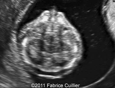 Cleft_Cuillier_5