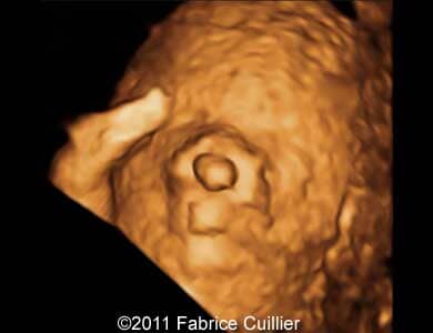 Cleft_Cuillier_7