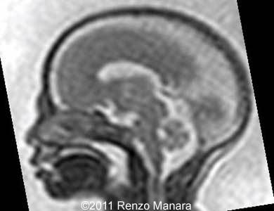 COW_294_MRI_6