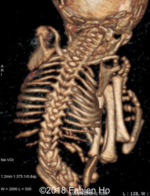 CT 1