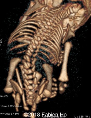 CT 2