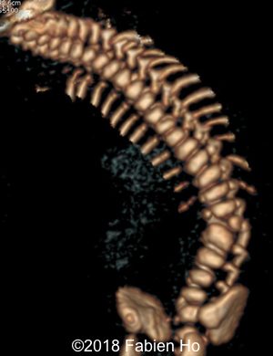 CT 3