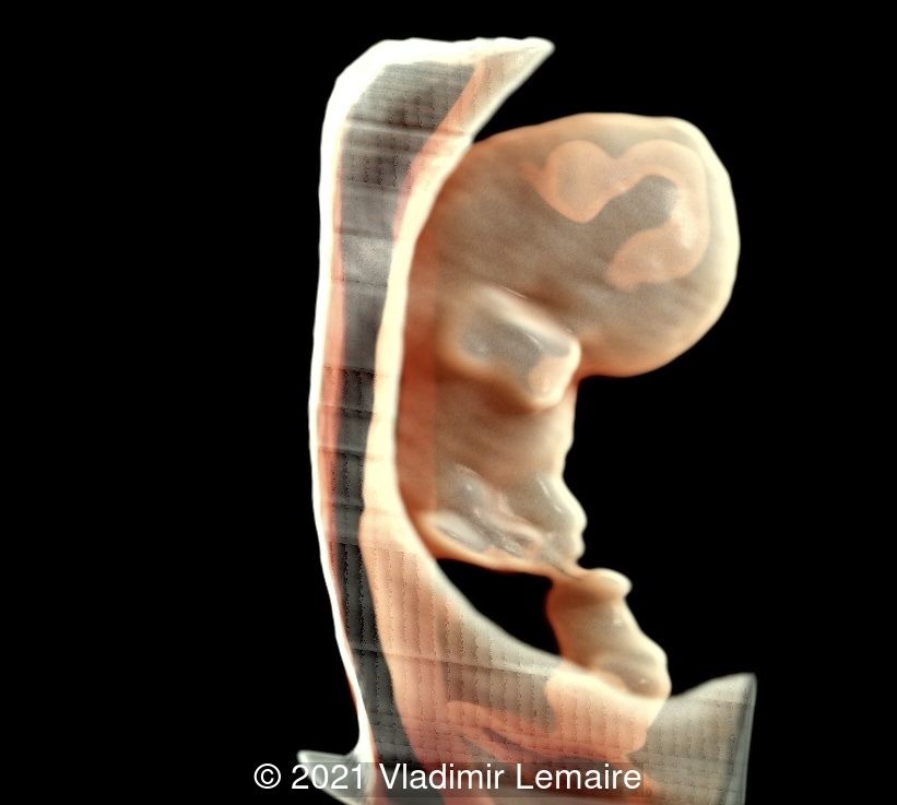 A rendered image of the same embryo in Silhouette mode.