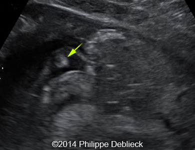 fig01b