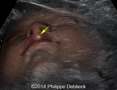 fig01c