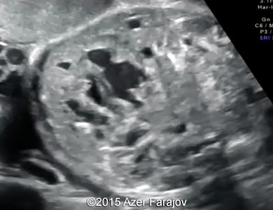Fig02