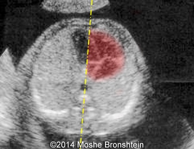 Fig04b
