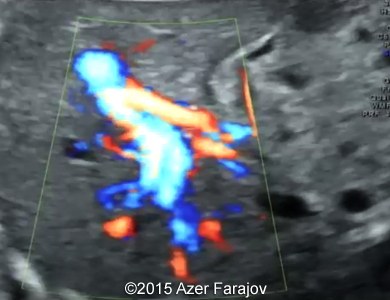 Fig05