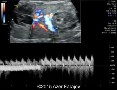 Fig06