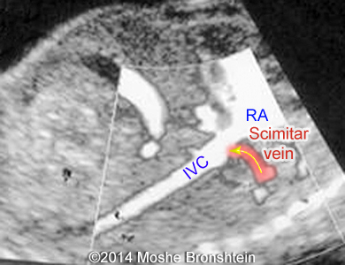 Fig06b