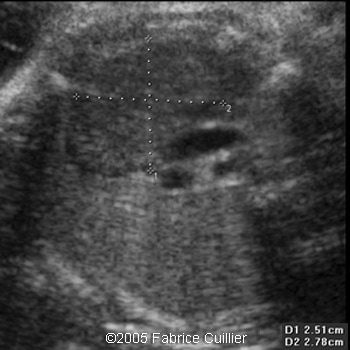 fig30