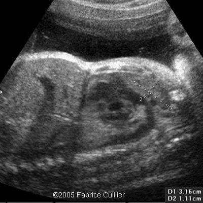 fig8