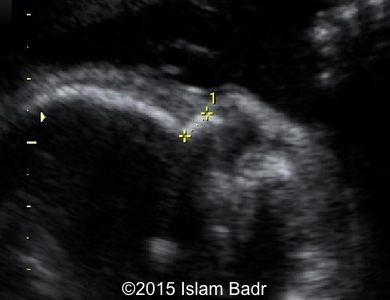 Image 1 B