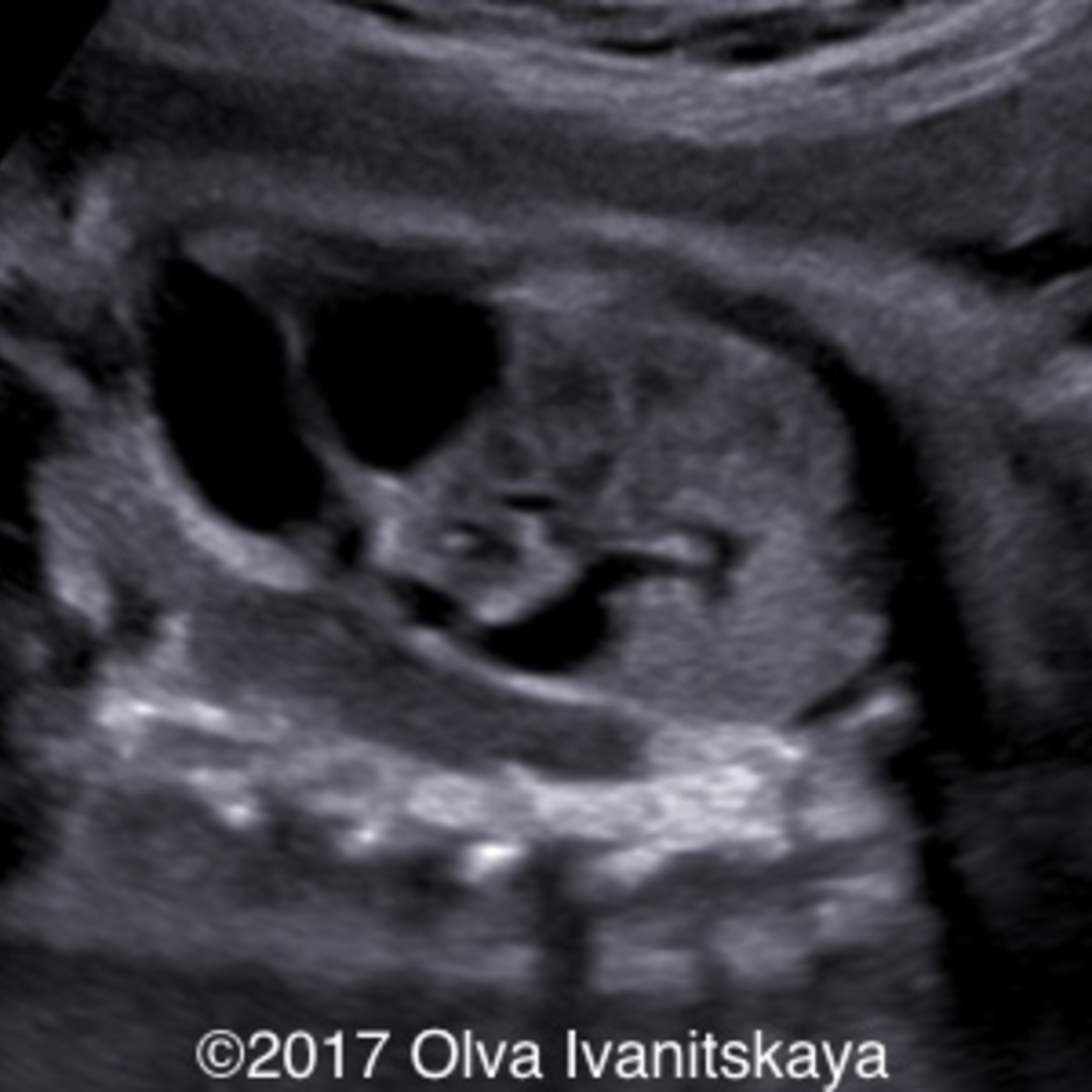 Case of the Week 440