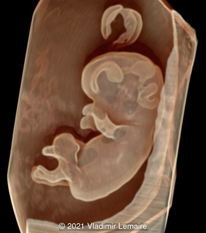 Lateral view of early brain development using Silhouette mode.