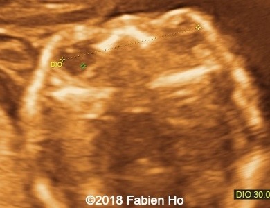 Image3