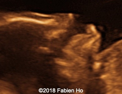 Image4