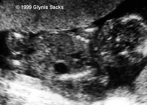 Image65