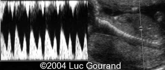 Luc4