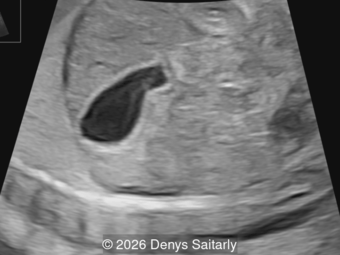 Case of the Week #653