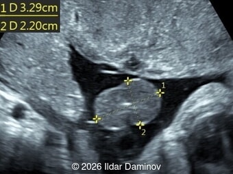 Case of the Week # 658