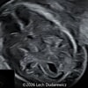Case of the Week # 657