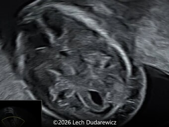 Case of the Week # 657