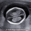 Case of the Week # 659