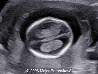 Case of the Week # 659