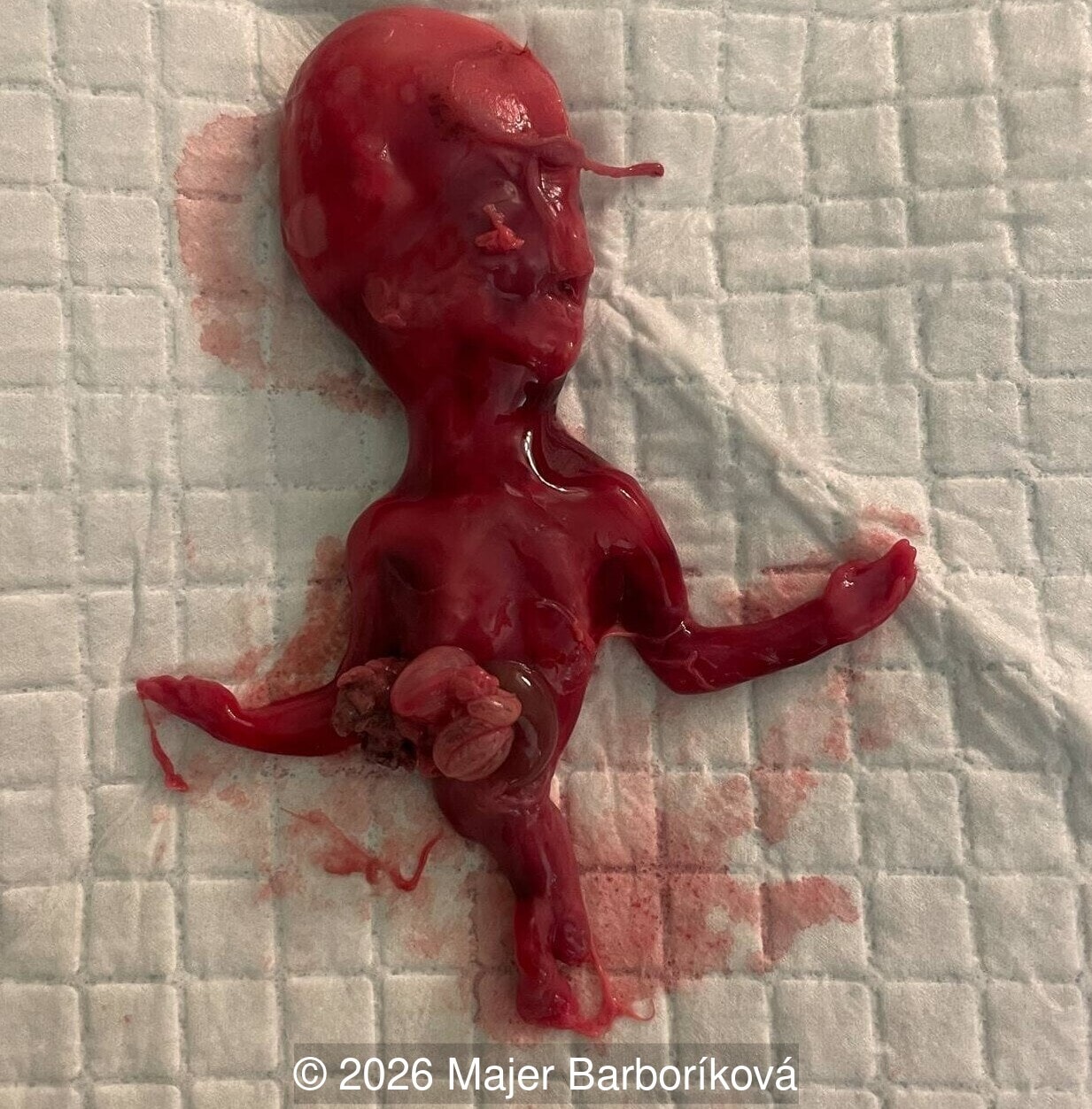 Fetus after termination 