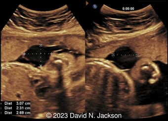 Case of the Week #583
