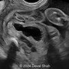 Case of the Week #615