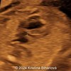 Case of the Week #614