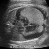 Case of the Week #618