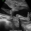 Case of the Week #627