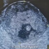 Case of the Week #628