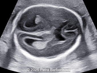 Case of the Week #639