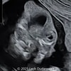 Case of the Week #638